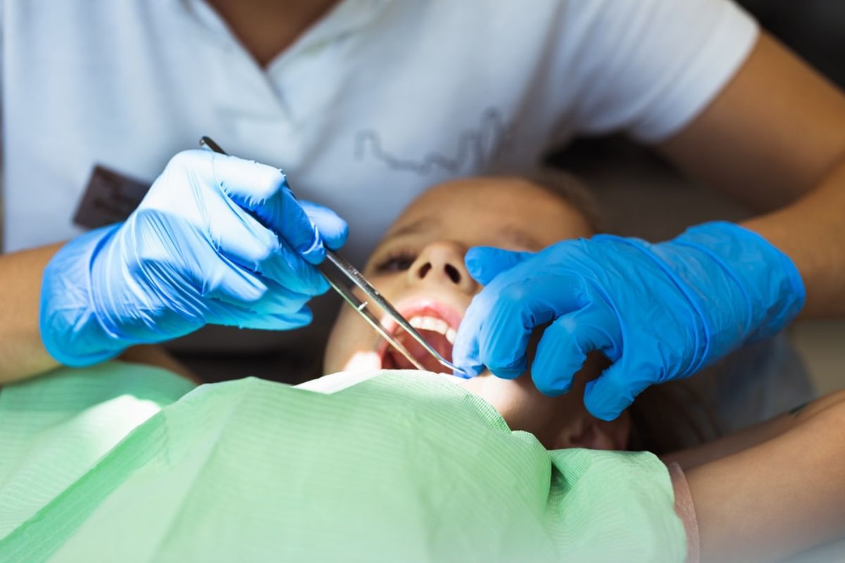 Dental Bonding for Kids